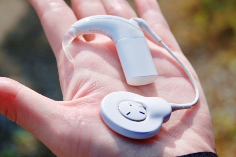 補聴器とは何ですか?